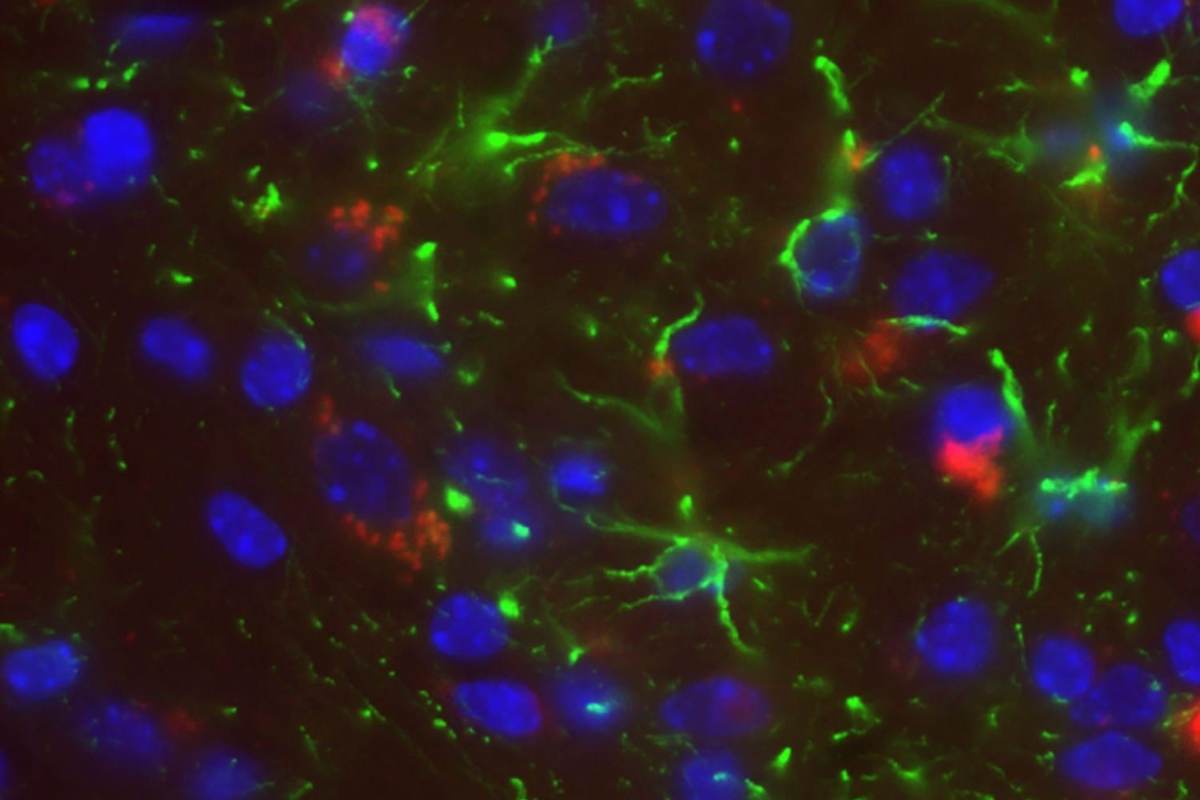 Svelati i cibi che infiammano il cervello