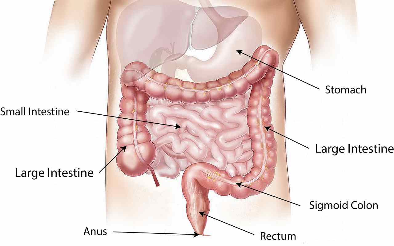 Tumore al colon