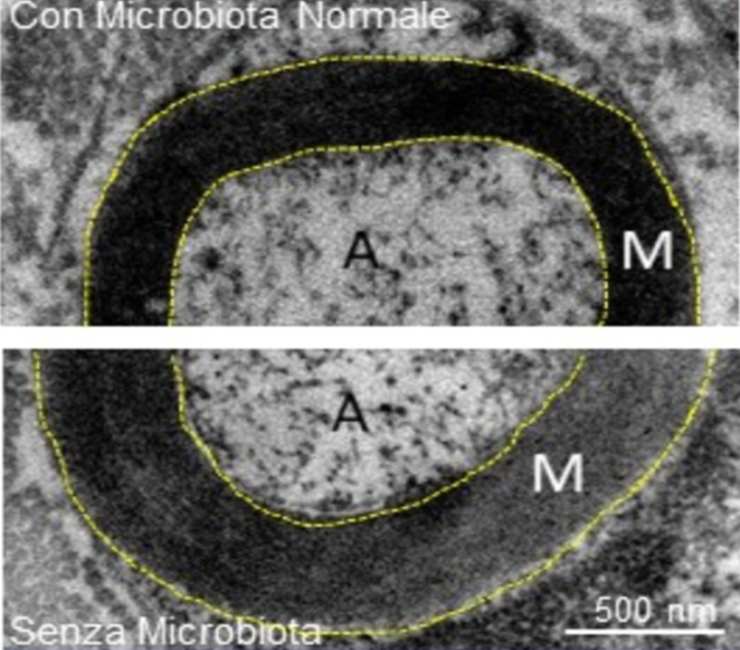 Ricerca: dimostrato l'asse tra intestino e nervi periferici