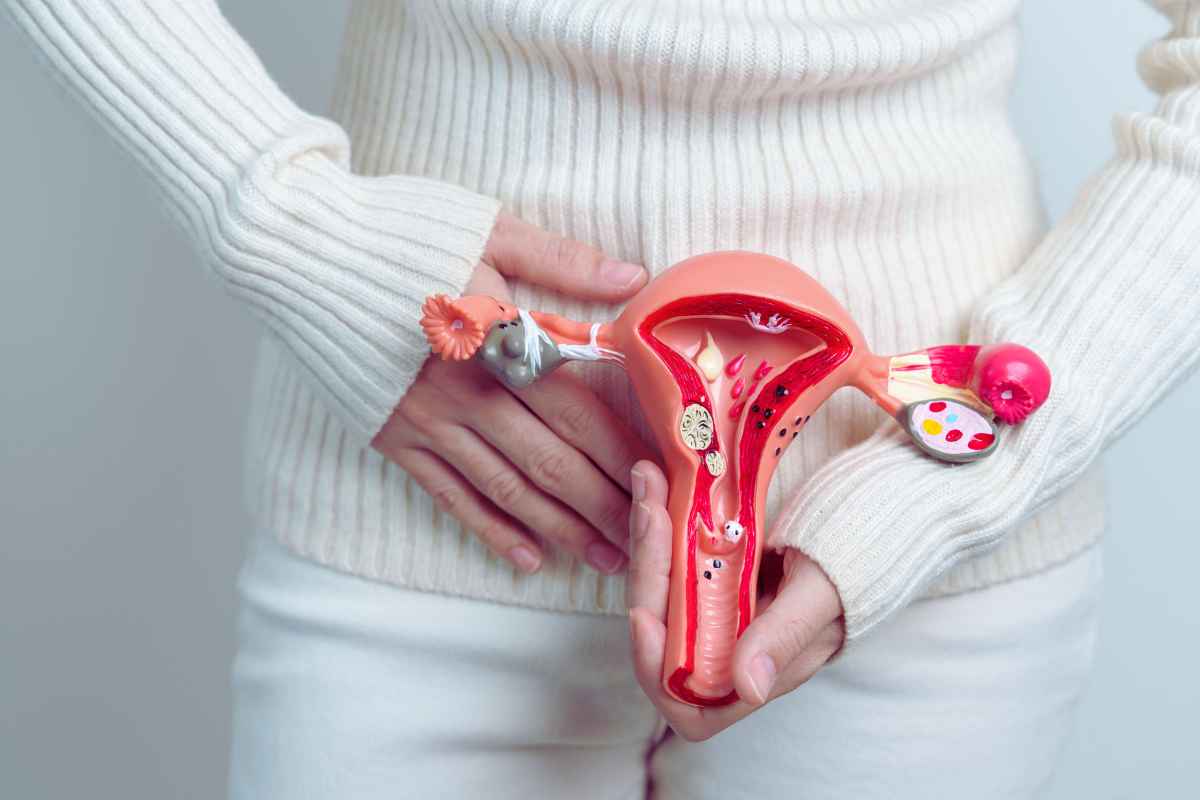 Endometriosi, cibi da evitare a tutti i costi